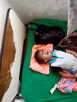 الكوليرا في اليمن 