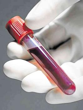 عمر الانسان 