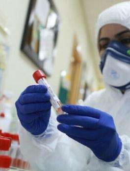 فيروس كورونا والاعراض 