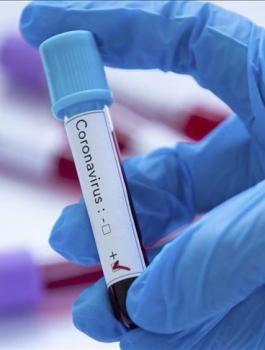 اصابات بفيروس كورونا في فلسطين 