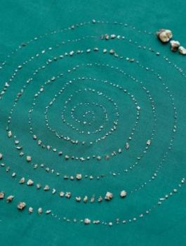 اطباء اسنان يتلعون أسنان من مريض هندي 