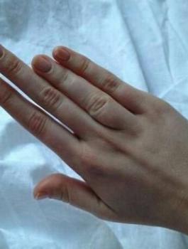 صاحب الاصابع الطويلة وفيروس كورونا 