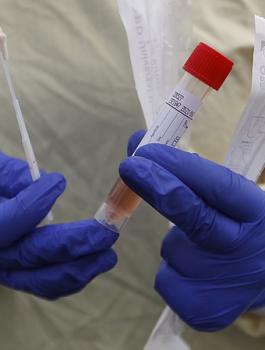 اصابات بفيروس كورونا في الضفة الغربية 