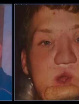 زرع وجه كامل بأميركا