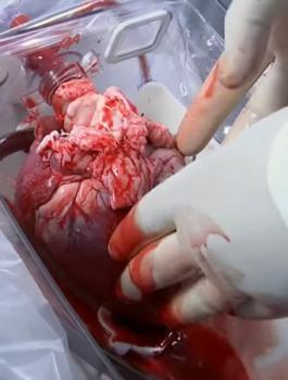 الطفل عساكرة 