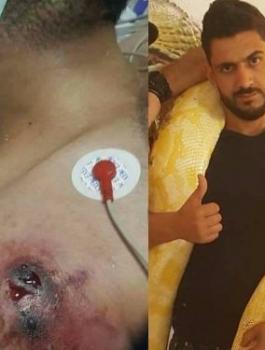 خبير الافاعي رعد الراعي 