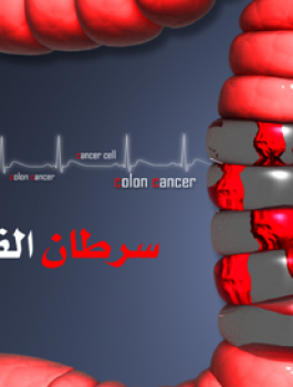 سرطان القولون