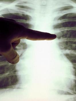 معاناة مصابي كورونا 