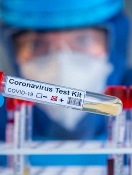 INAF_20200607213523264