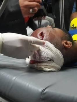 إصابة خطيرة للاعب شباب جباليا بحجر ألقي من الجماهير 