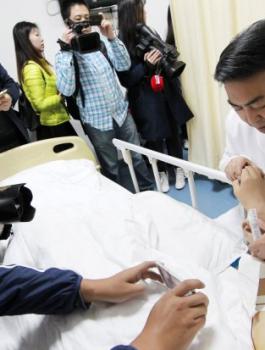 .أطباء صينيون يزرعون أذناً في ذراع شخص