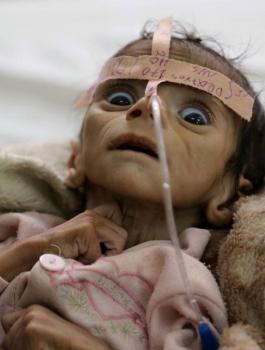 الامراض في اليمن 