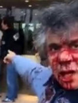 الجزائري رشيد نكاز يتعرض للضرب 