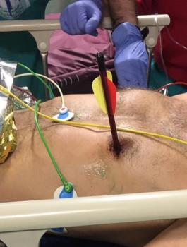 اصابة سهم في قلبه 