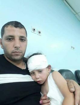 اصابة طفلتين بحجارة المستوطنين 