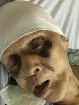 وفاة مسنة مصرية بعد تعرضها للتعذيب من قبل ابنها 