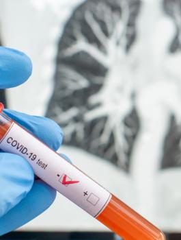 وفيات بكورونا في العالم 