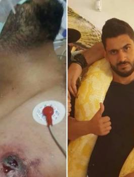 خبير الافاعي الاردني يصارع الموت 