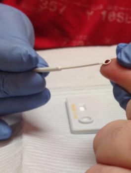 العلماء وشفاء حالة ثانية من علاج الايدز 