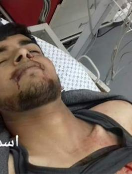 شهيدان برصاص الاحتلال شرق خانيونس بقطاع غزة