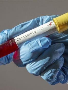 اصابات بفيروس كورونا في اسرائيل 