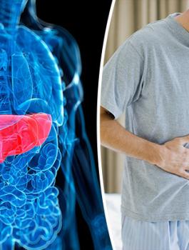 سرطان الكبد 