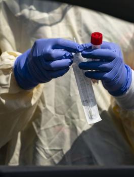 الاصابات بفيروس كورونا 