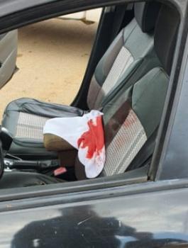 مقتل فتاة طعنا في عرابة 