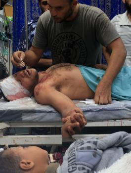 الصليب الأحمر: مشفى واحد لكل 129 ألف شخص في غزة