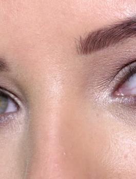 اردني يقتلع عيني زوجته 