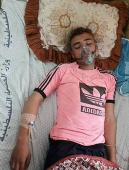 غاز مجهول اطلقه الاحتلال يسبب تشنجات واضرابات عصبية لشاب منذ 6 أيام
