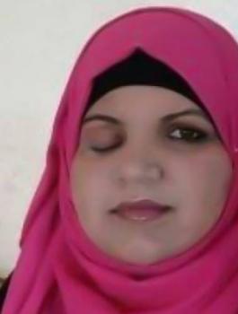 التقاط