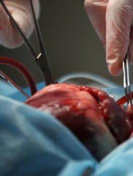 التبرع بالاعضاء في فلسطين 