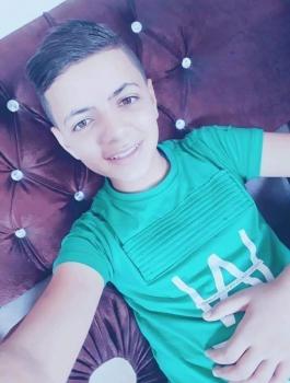 وفاة فتى بغزة اثر احراق نفسه 