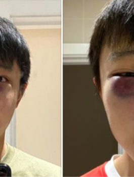 الاعتداء على طالب سنغفوري 