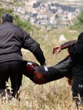 اصابة فتى بجراح خطيرة في بلدة تقوع 