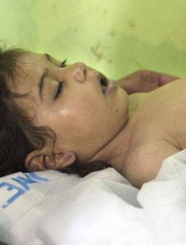 الهجمات الكيماوية في دوما 