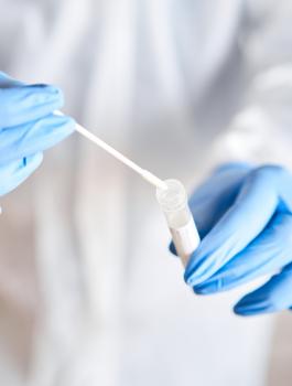 الاصابات بفيروس كورونا في العالم 