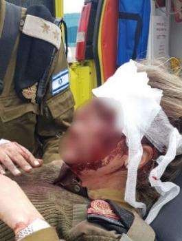 مجندة اسرائيلية تتعرض للضرب في جنين 