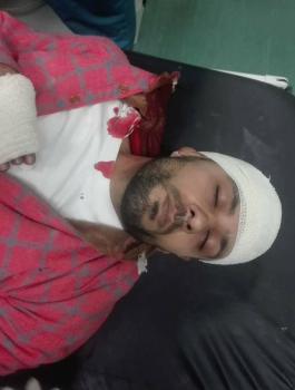 اصابة الصحفي علي دار علي 