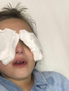 مجهول يهاجم أطفال فلسطينيين خلال عودتهم من المدرسة ويرشهم بغاز الفلفل