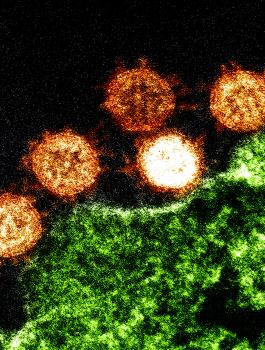 الاردن وفيروس كورونا 