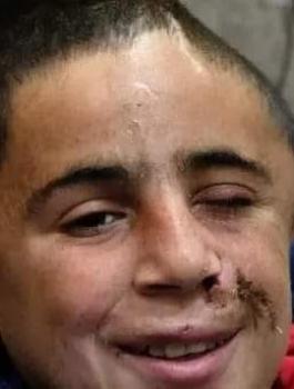 اعتقال محمد التميمي 