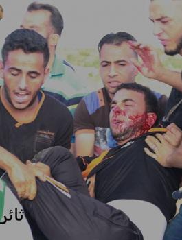 اصابتان احداهما خطيرة خلال مواجهات شرق جباليا http://ramallah.news/post/84736