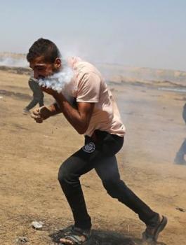 قنبلة غاز تصيب وجه شاب فلسطيني 