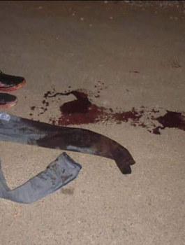 الاسير المصاب محمد حسنين 