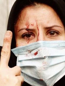 اغتصاب نساء حلب 