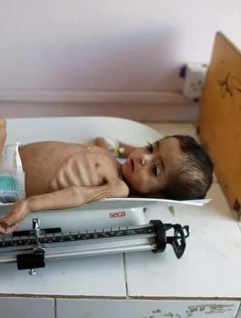 الاطفال في اليمن 