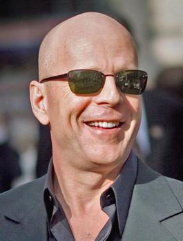 الصلع والجمال 