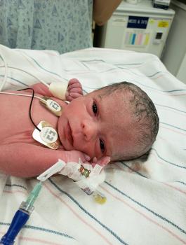 مولودة بعمر اليوم تخضع لعملية قيصرية 